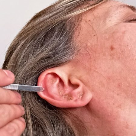 Auriculoterapia 2 jpeg