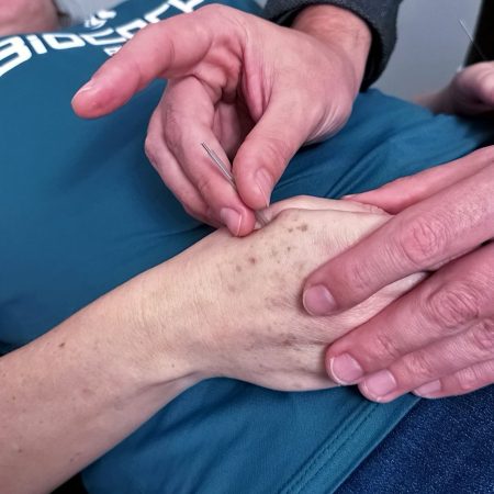 acupuntura serviços 2