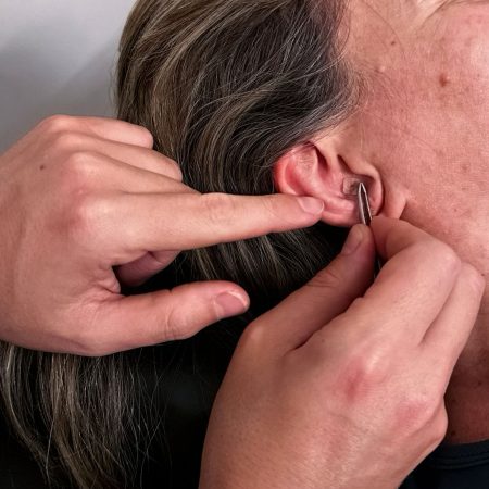 serviço auriculoterapia (2)